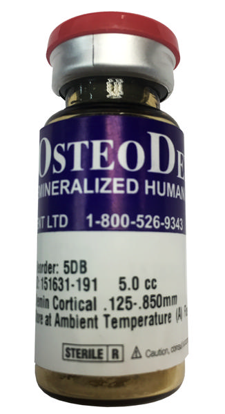 OsteoDemin Demineralized Irradiated Cortical Bone Matrix (DBM) Allograft
